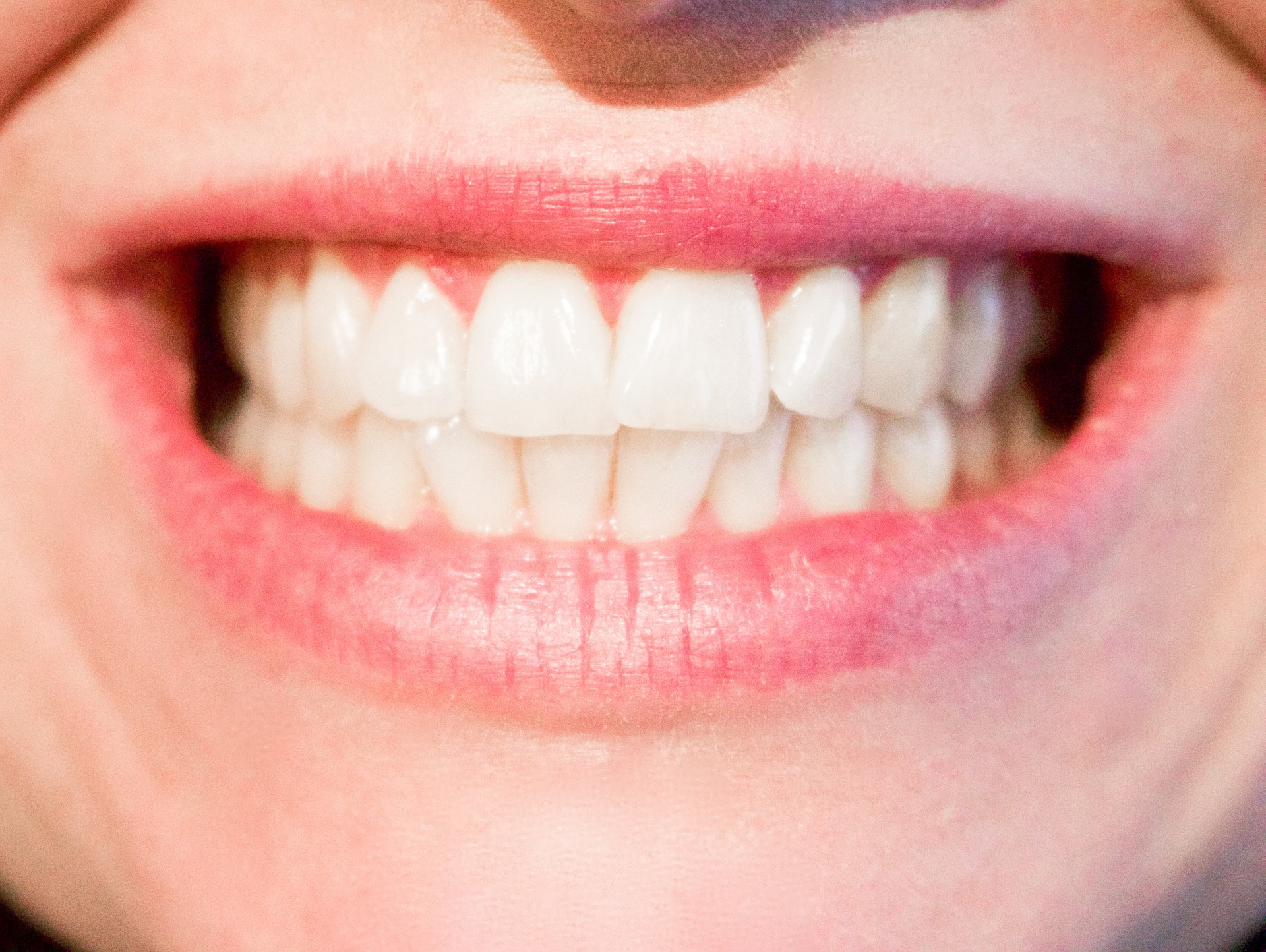 Why Are Routine Dental Checkups so Important? | ALF Family Dentistry | Dentist in Scranton, PA
